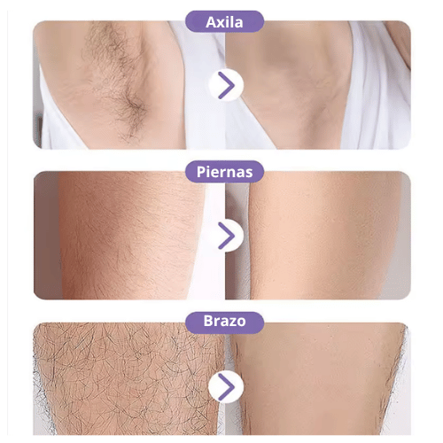 DEPILADORA DE CRISTAL