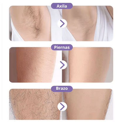 DEPILADORA DE CRISTAL