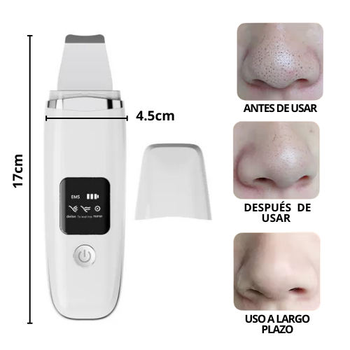 LIMPIADOR FACIAL ULTRASONICO
